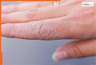 सर्दियों में रूखे हाथों का रामबाण इलाज हैं ये 5 घरेलू नुस्खें, मिनटों में हो जाएंगे नरम और मुलायम