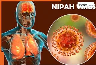 Nipah virus creates stir after cases detected in West Bengal, many countries issue alerts