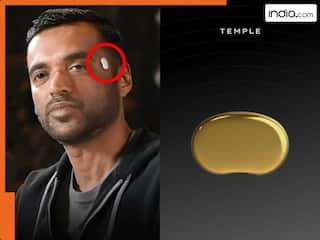 Zomato CEO की कनपटी पर दिखा रहस्यमयी Golden डिवाइस क्या है? चिप की ये खासियत उड़ा देगी होश