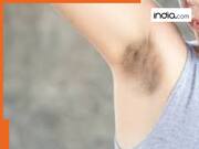 क्यों काली पड़ जाती हैं अंडरआर्म्स? आपकी ये गलतियां हो सकती हैं जिम्मेदार, इन चीजों से तुरंत पाएं राहत