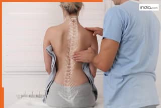 क्या लंबे समय तक झुककर बैठने से Scoliosis की समस्या होने लगती है? जानें क्या कहते हैं डॉक्टर