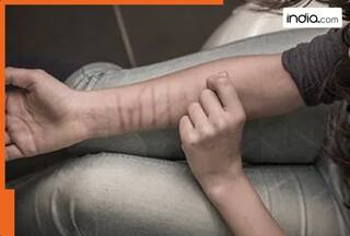 35 students of Dhamdaha Middle School in Chhattisgarh found with deep cut marks on hands