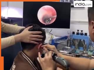 VIDEO: बच्चे के कान में घुस गई ऐसी चीज, देखकर खुद डॉक्टर के रोंगटे खड़े हो गए | देखिए वीडियो