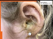 कान से बहने वाले तरल पदार्थ को न करें अनदेखा, इन उपायों से पाएं दर्द पर नियंत्रण
