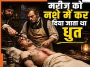 जब बेहोशी की दवा नहीं थी तो कैसे होती थी सर्जरी? कभी शराब पिलाकर तो कभी...