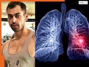 पोस्टमार्टम रिपोर्ट में हुआ खुलासा, लंग्स की इस बीमारी ने ली प्रतीक यादव की जान! ये लक्षण दिखने पर आप भी तुरंत हो जाएं सावधान