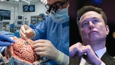 China beats Elon Musk by launching first commercial brain-chip ahead of Neuralink