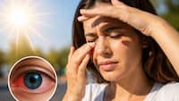 सिर्फ स्किन नहीं, धूप से जल सकती है आपकी Cornea, इन लक्षणों को भूलकर भी न करें नजरअंदाज