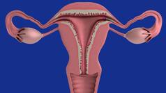 World IVF Day 2026: Struggling to conceive with PCOS? Here's what an expert says