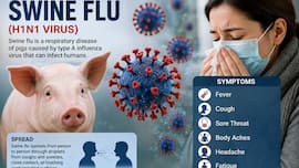 Swine flu cases rising in Delhi; what are the symptoms? Doctors issue warning and advise caution