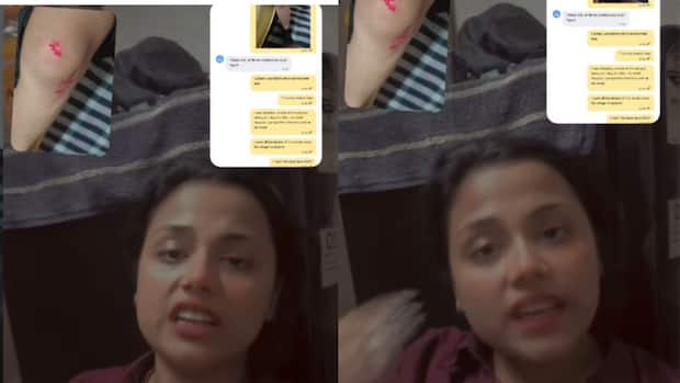 ‘Fearing for my safety’: Delhi woman jumps from moving Rapido bike, suffers injuries | Viral