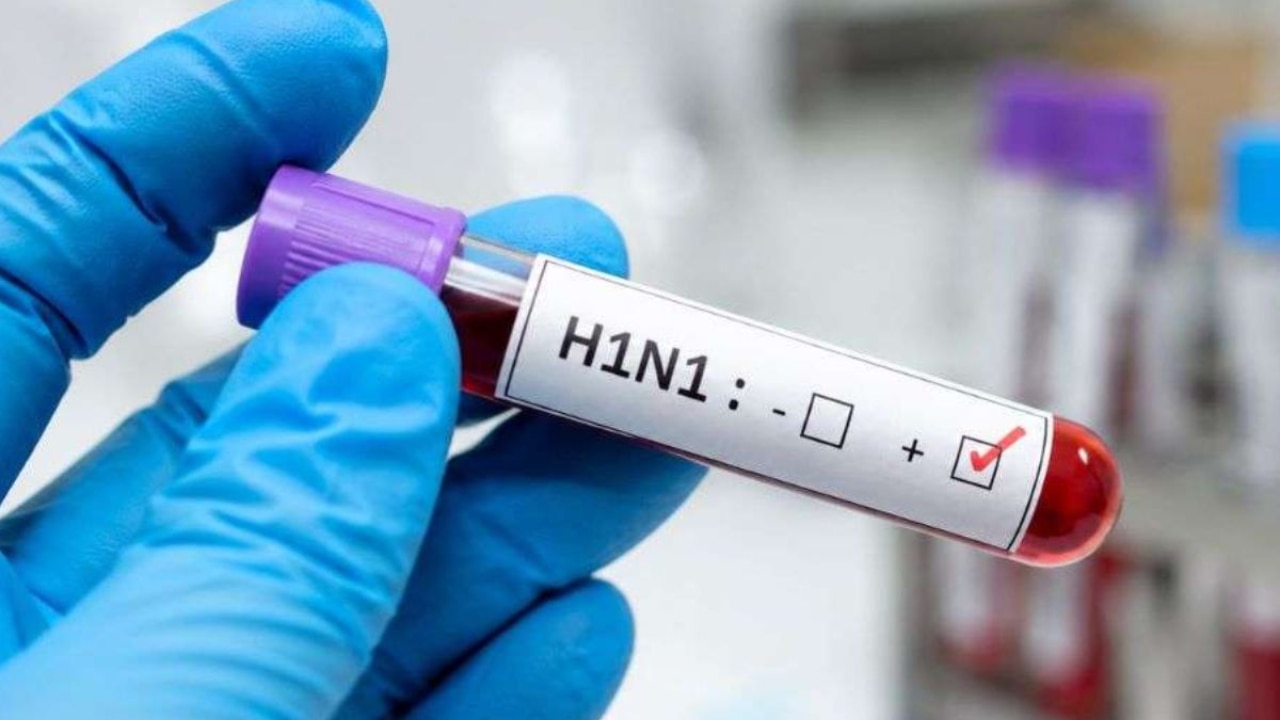 Swine flu in Delhi: Govt lists H1N1 symptoms; know causes, treatment, and prevention