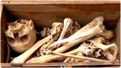 Delhi Shocker: Human skeleton-like bones found in scrap, cleanliness drive turns into police investigation