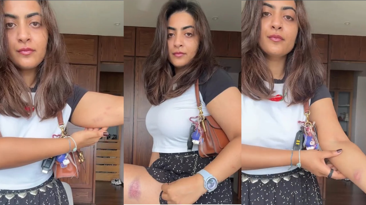 Aamir Khan's niece Zayn Marie shows injury marks after detention in Mumbai during Kranti Maidan protest - Watch