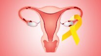 Endometriosis Awareness Month: What you Need to Know About its Symptoms, Diagnosis and Treatment